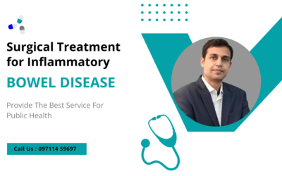 Blogs Surgical Treatment for Inflammatory Bowel Disease