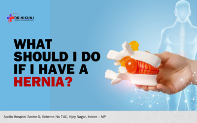What should I do if I have a hernia?