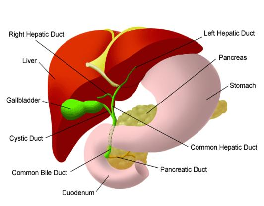 Percutaneous Transhepatic Biliary Drainage (PTBD) And Metallic Stenting