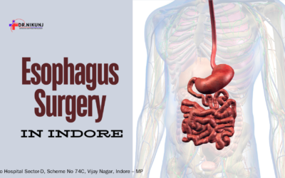 Esophagus Surgery in Indore