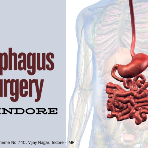 Esophagus Surgery in Indore