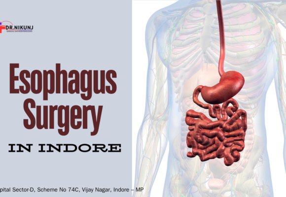 Esophagus Surgery in Indore