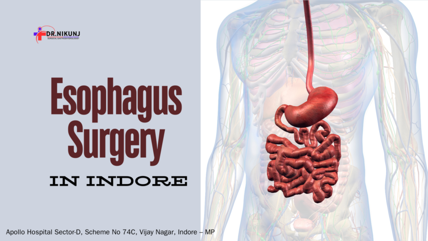 Esophagus Surgery in Indore