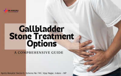 Ultimate Guide to Gallbladder Stone Treatment Options