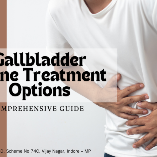 Ultimate Guide to Gallbladder Stone Treatment Options