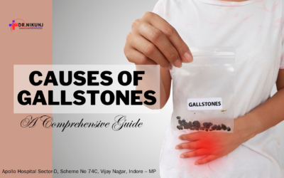 Understanding the Causes of Gallstones: A Comprehensive Guide