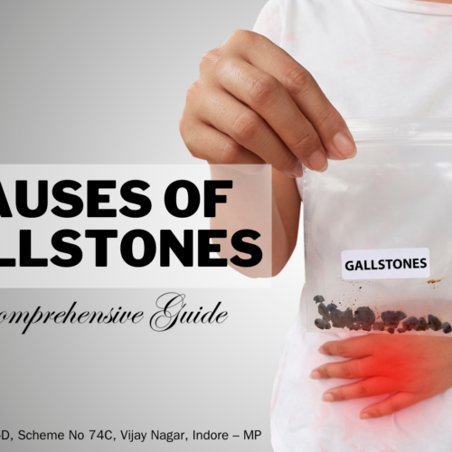 Understanding the Causes of Gallstones: A Comprehensive Guide