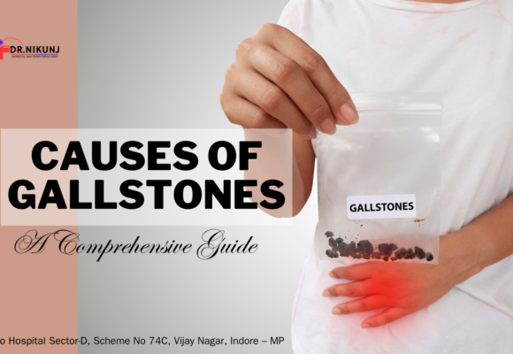 Understanding the Causes of Gallstones: A Comprehensive Guide