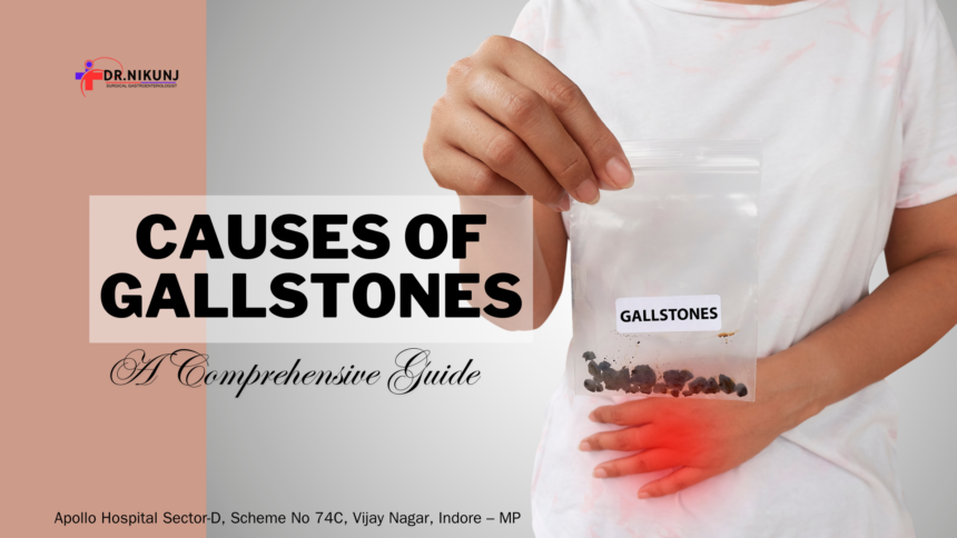 Understanding the Causes of Gallstones: A Comprehensive Guide