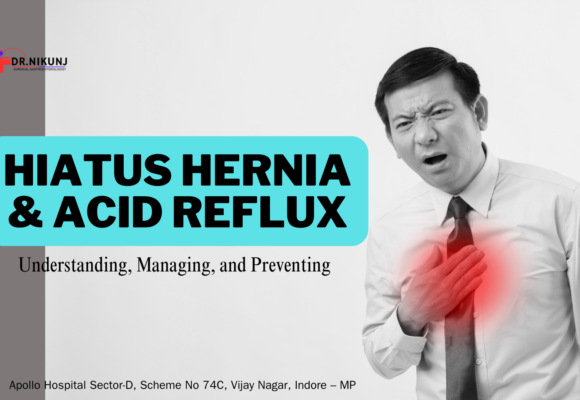 Hiatus Hernia & Acid Reflux: Understanding, Managing, and Preventing