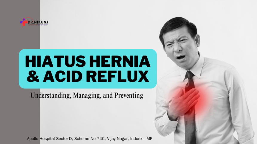 Hiatus Hernia & Acid Reflux: Understanding, Managing, and Preventing