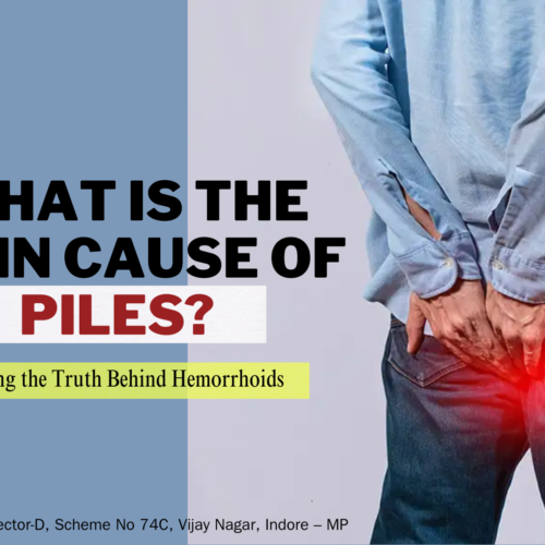 What is the Main Cause of Piles? Uncovering the Truth Behind Hemorrhoids