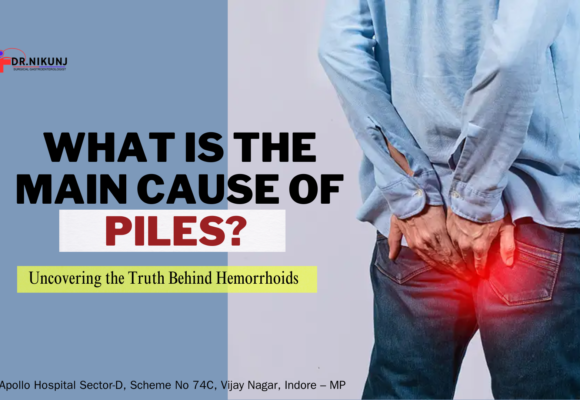 What is the Main Cause of Piles? Uncovering the Truth Behind Hemorrhoids