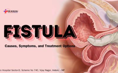 Fistula: Causes, Symptoms, and Treatment Options