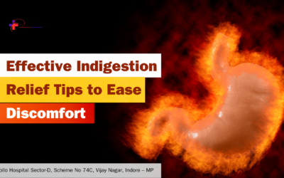 Effective Indigestion Relief Tips to Ease Discomfort