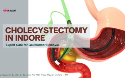 Cholecystectomy in Indore: Expert Care for Gallbladder Removal
