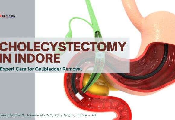 Cholecystectomy in Indore: Expert Care for Gallbladder Removal