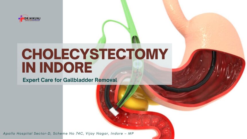 Cholecystectomy in Indore: Expert Care for Gallbladder Removal