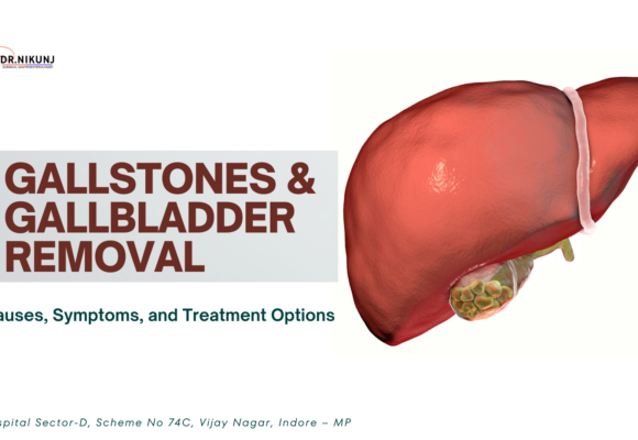 Gallstones and Gallbladder Removal: Causes, Symptoms, and Treatment Options