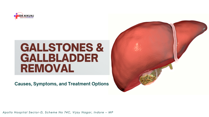 Gallstones and Gallbladder Removal: Causes, Symptoms, and Treatment Options