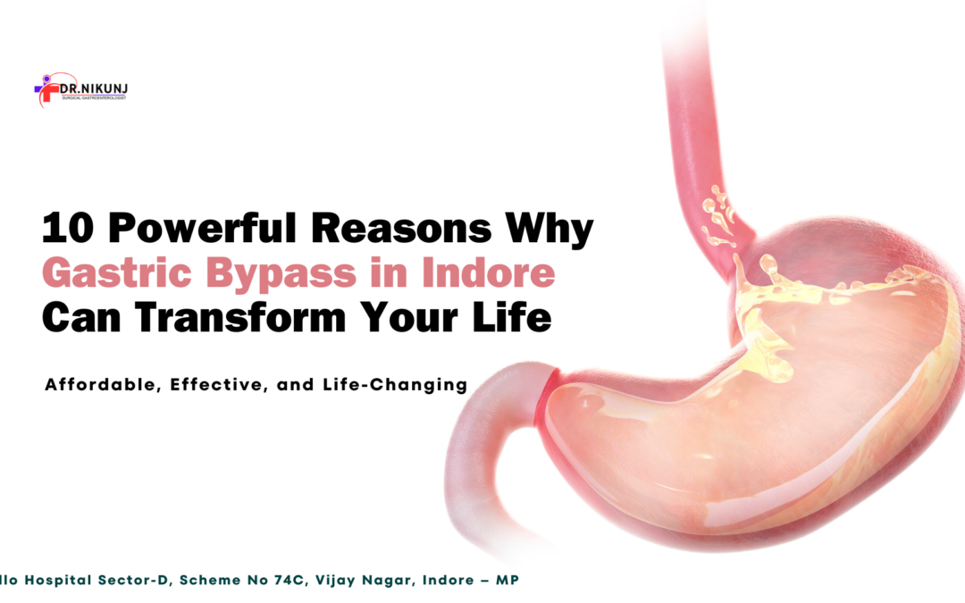 Gastric Bypass Surgery in Indore | Dr. Nikunj