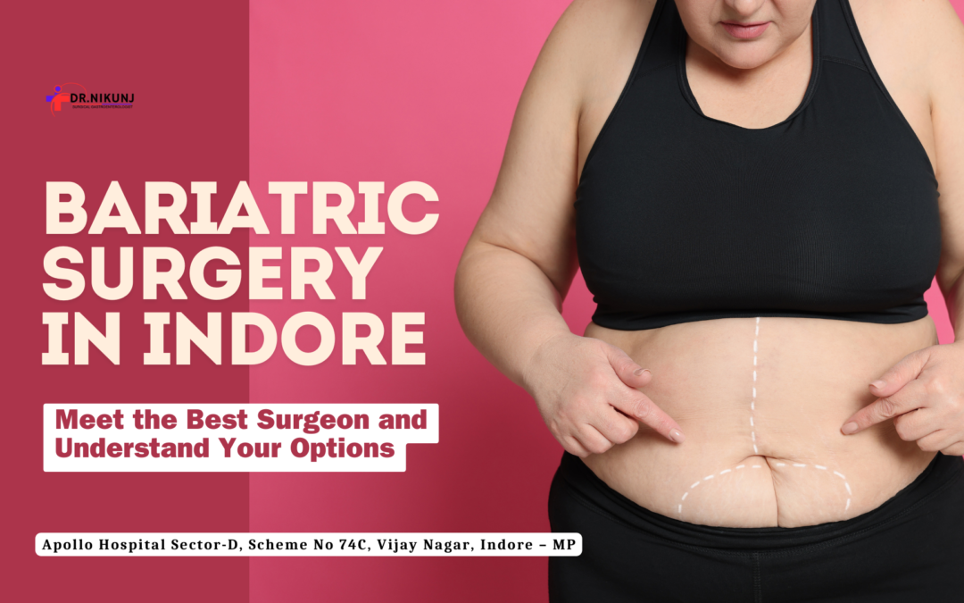Bariatric Surgery in Indore: Meet the Best Surgeon and Understand Your Options