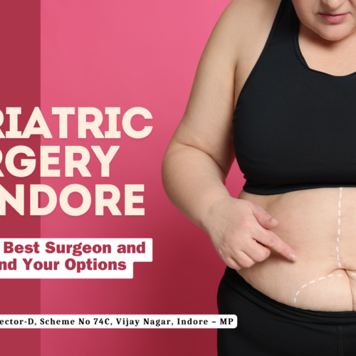 Bariatric Surgery in Indore with Dr. Nikunj Jain