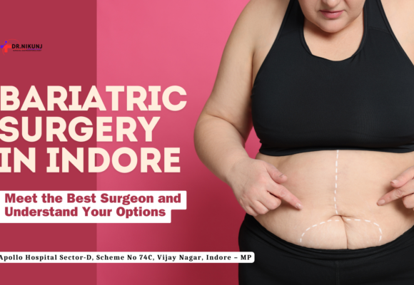 Bariatric Surgery in Indore with Dr. Nikunj Jain