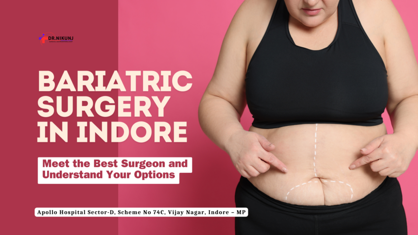 Bariatric Surgery in Indore with Dr. Nikunj Jain