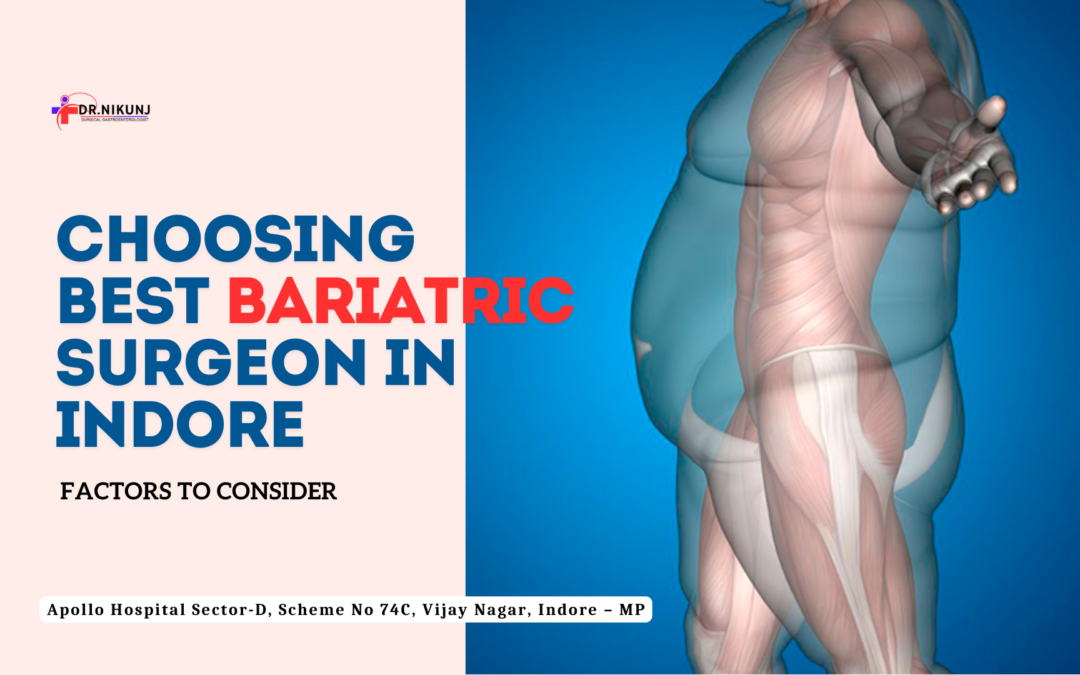 Choosing the Best Bariatric Surgeon in Indore: Factors to Consider