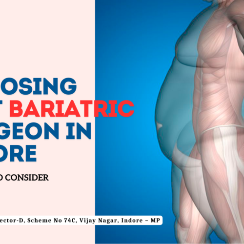 Choosing Bariatric Surgeon in Indore