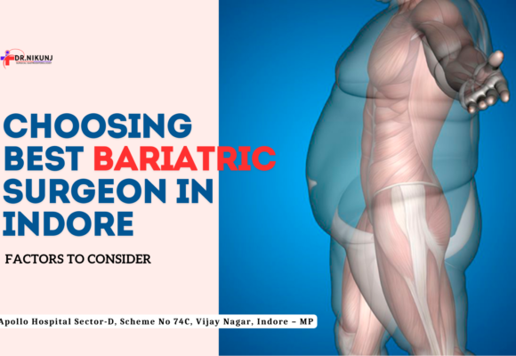 Choosing Bariatric Surgeon in Indore