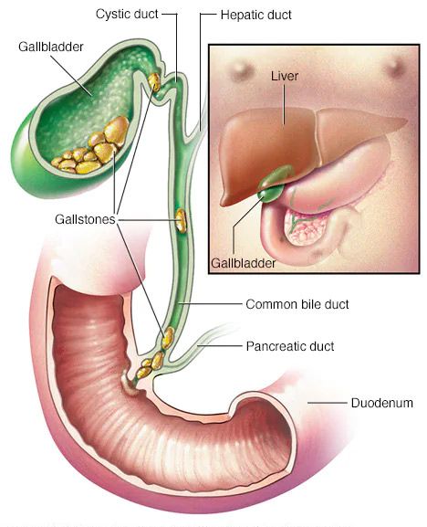 Gallbladder and Piles Treatment Vijay Nagar Indore
