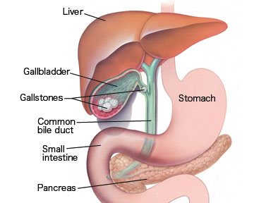 Gallbladder and Piles Treatment Vijay Nagar Indore
