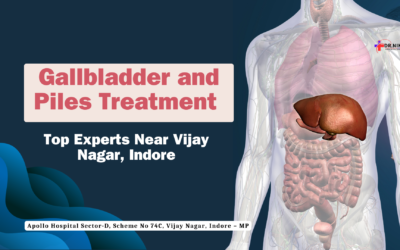 Gallbladder and Piles Treatment: Top Experts Near Vijay Nagar, Indore
