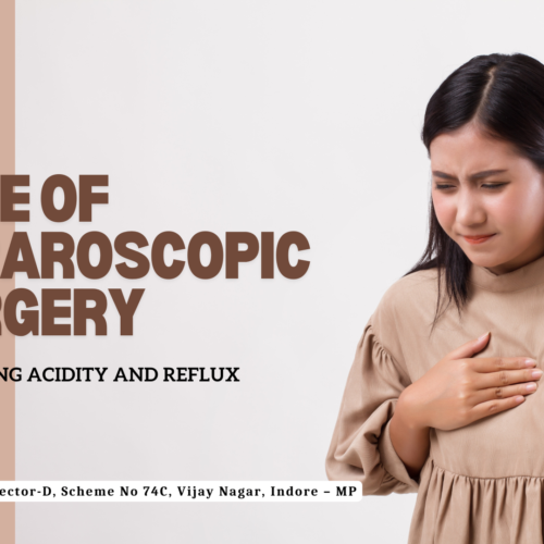 Laparoscopic Surgery for Treating Acidity and Reflux Problems