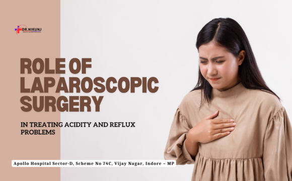 Laparoscopic Surgery for Treating Acidity and Reflux Problems