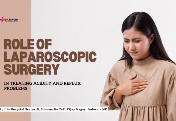 Laparoscopic Surgery for Treating Acidity and Reflux Problems