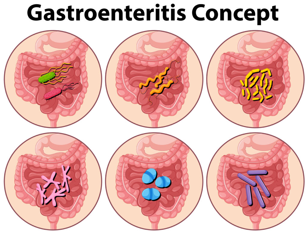 Laparoscopic Gastro Surgery Indore