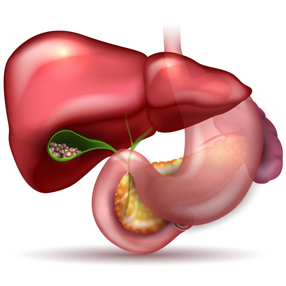 Gallstones Doctors in Indore