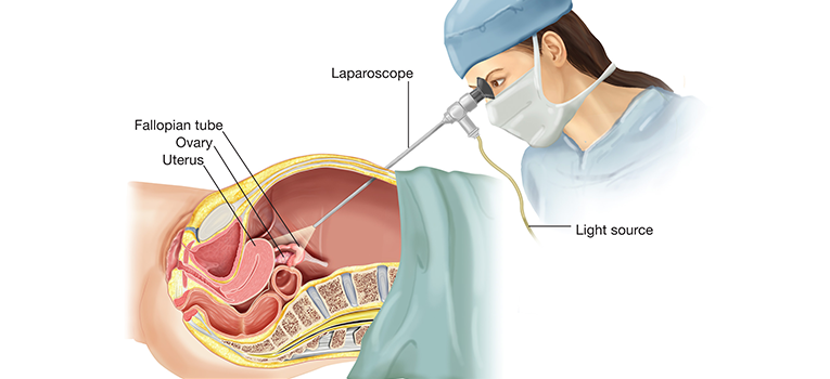 Showing a doctor performing Laparoscopic surgery.