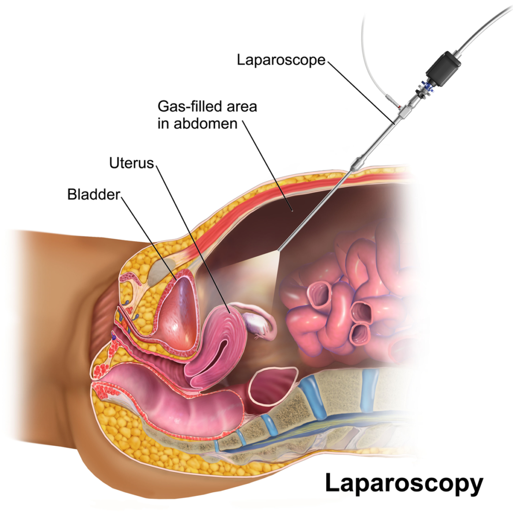 This image is showing the body parts name which is related to Laparoscopy.