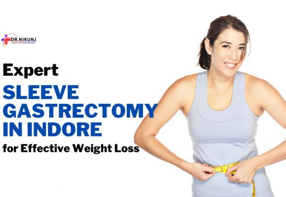 Sleeve Gastrectomy in Indore