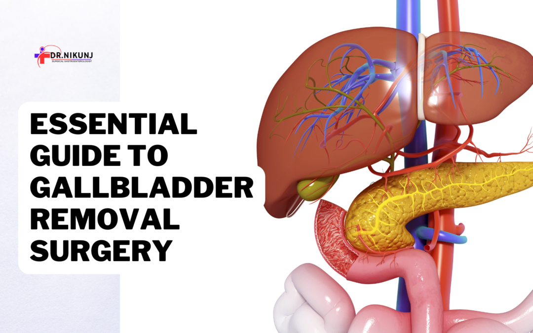 Essential Guide to Gallbladder Removal Surgery