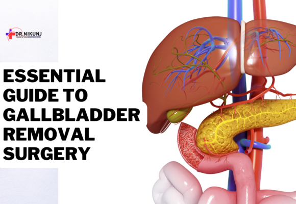 Essential Guide to Gallbladder Removal Surgery