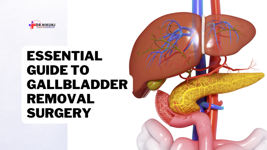 Essential Guide to Gallbladder Removal Surgery