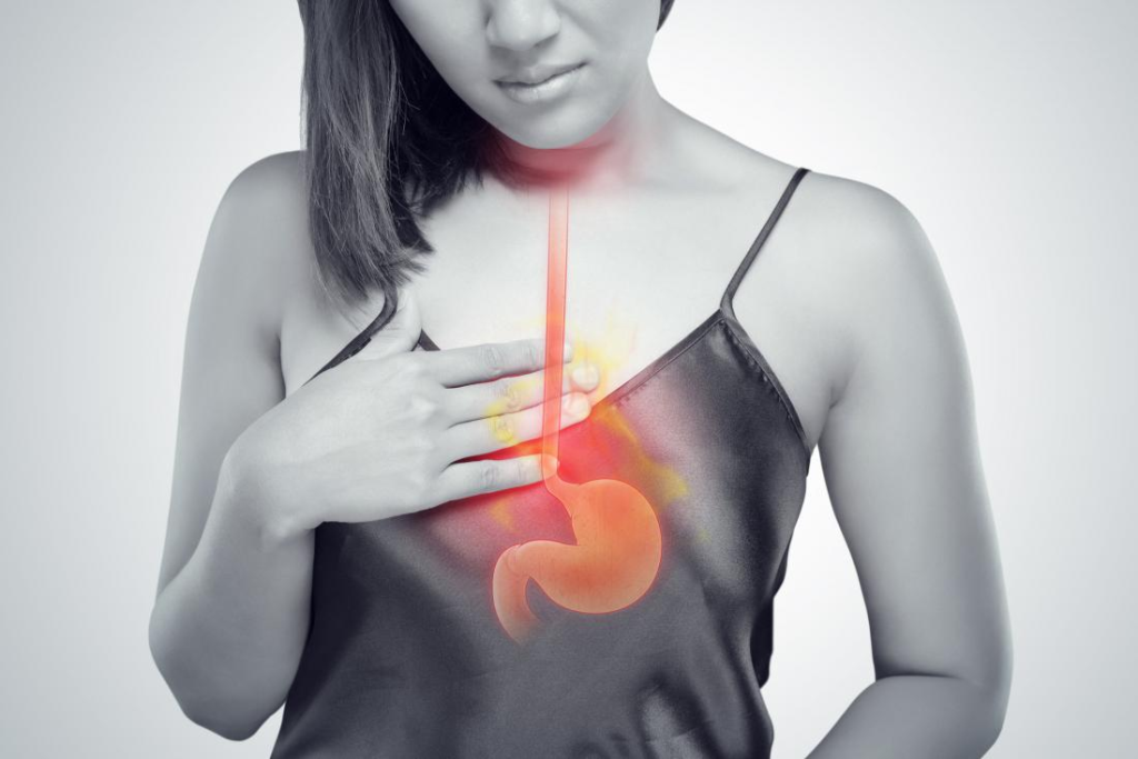 Effective Acid Reflux Treatment in Indore