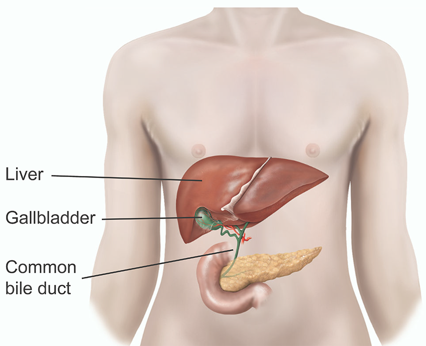 Gallbladder Removal Surgery