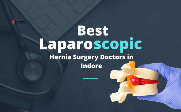 Best Laparoscopic Hernia Surgery Doctors in Indore: Get Treatment