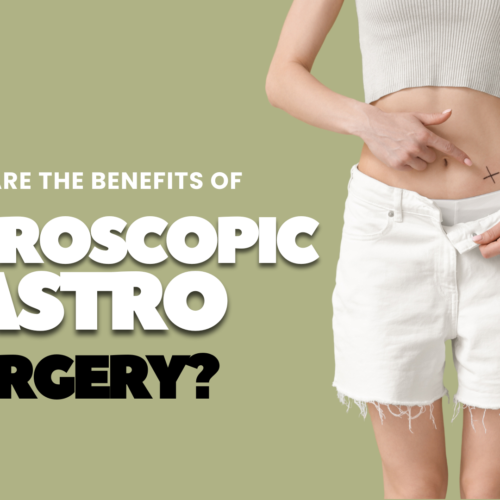 What Are the Benefits of Laparoscopic Gastro Surgery?